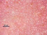 4 - Cellule corticali in visione superficiale